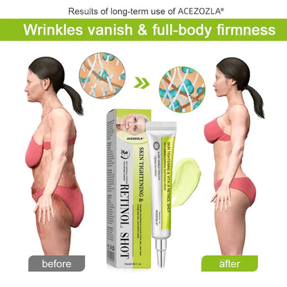 ✨Final 3 Hours: 70%OFF🔥Acezozla™ Botulinum & Vita-A Retinol Shot Wrinkle-Lift Tightening cream✨
